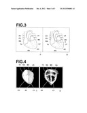 IMAGE PROCESSING DEVICE, METHOD AND PROGRAM diagram and image