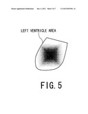 IMAGE PROCESSING APPARATUS, X-RAY CT APPARATUS AND IMAGE PROCESSING METHOD diagram and image