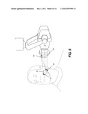 METHOD FOR GENERATING AN INTRAORAL VOLUME IMAGE diagram and image