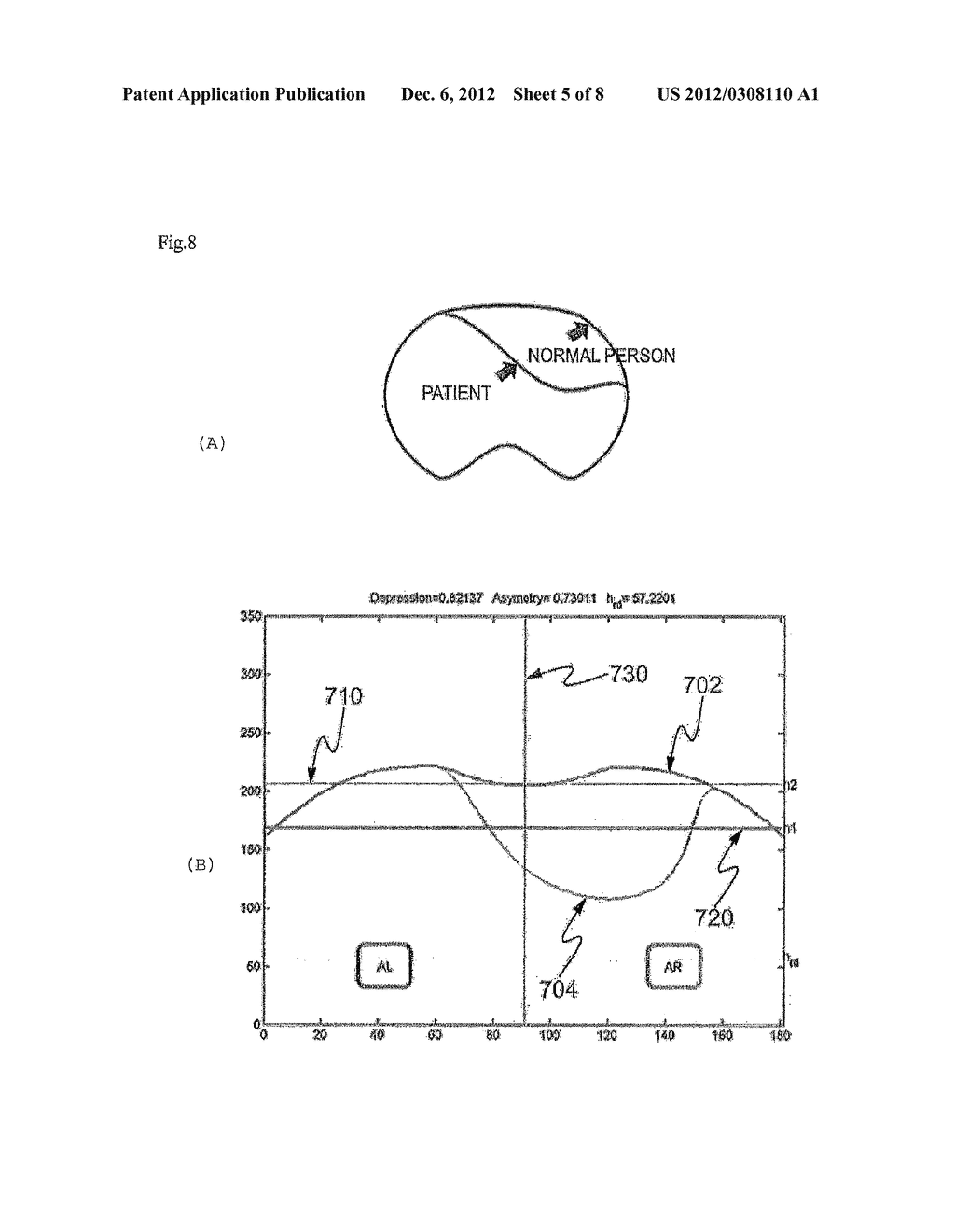 Automation Method For Computerized Tomography Image Analysis Using     Automated Calculation Of Evaluation Index Of Degree Of Thoracic     Deformation Based On Automatic Initialization, And Record Medium And     Apparatus - diagram, schematic, and image 06