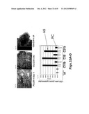 GENE PRODUCTS DIFFERENTIALLY EXPRESSED IN CANCEROUS CELLS diagram and image