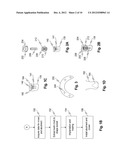 DENTAL DIAGNOSIC AND DENTAL RESTORATION METHODS, SYSTEMS, APPARATUSES, AND     DEVICES diagram and image