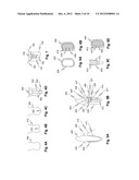 DENTAL DIAGNOSIC AND DENTAL RESTORATION METHODS, SYSTEMS, APPARATUSES, AND     DEVICES diagram and image