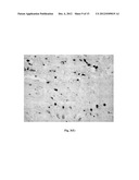 DETECTION OF UNHEALTHY BONE MARROW-DERIVED CELL FOR DISEASE     PREDISPOSITIONS diagram and image