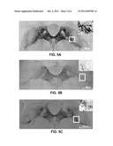 Use of Cysteamine in Treating Parkinson s Disease diagram and image