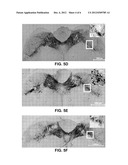 Use of Cysteamine in Treating Parkinson s Disease diagram and image