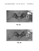 Use of Cysteamine in Treating Parkinson s Disease diagram and image