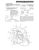 VENTRICULAR ASSIST DEVICE CANNULA AND VENTRICULAR ASSIST DEVICE INCLUDING     THE SAME diagram and image