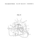 VENTRICULAR ASSIST DEVICE CANNULA AND VENTRICULAR ASSIST DEVICE INCLUDING     THE SAME diagram and image