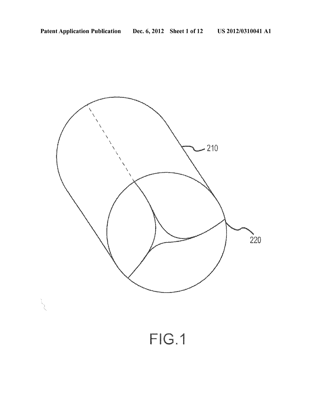 Percutaneously Implantable Replacement Heart Valve Device and Method of     Making Same - diagram, schematic, and image 02