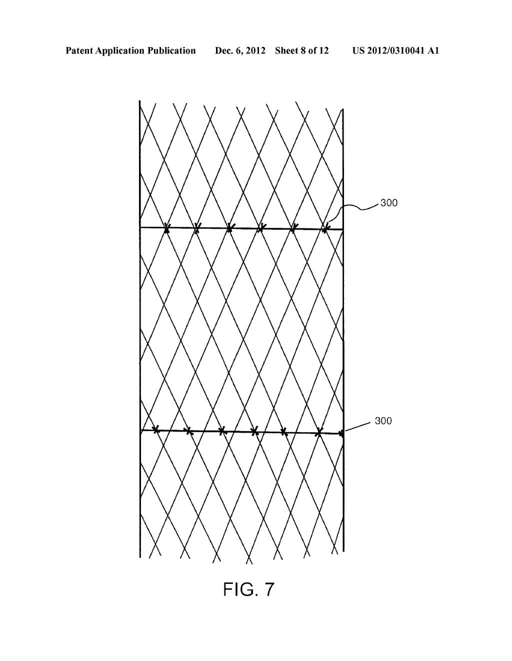 Percutaneously Implantable Replacement Heart Valve Device and Method of     Making Same - diagram, schematic, and image 09