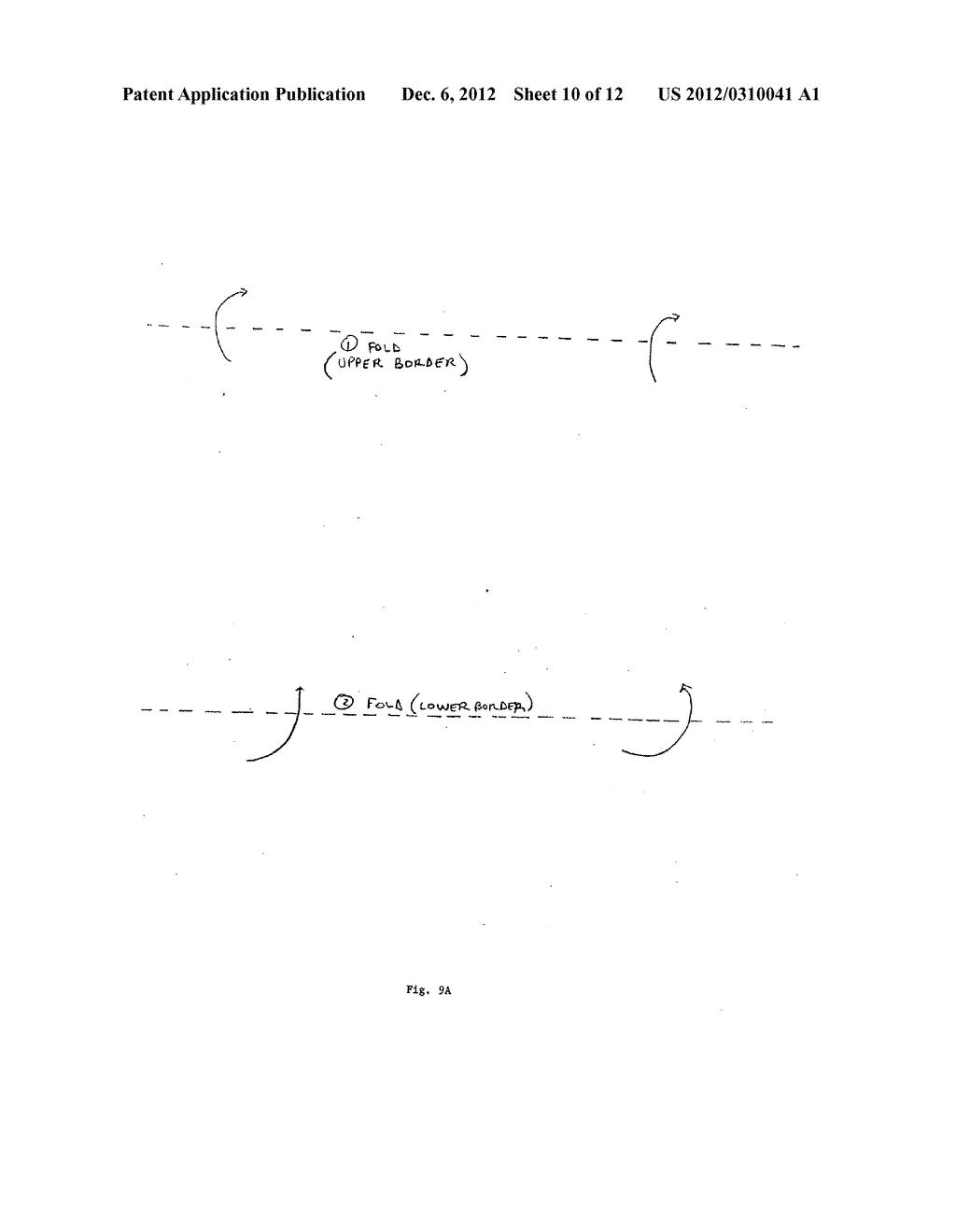 Percutaneously Implantable Replacement Heart Valve Device and Method of     Making Same - diagram, schematic, and image 11