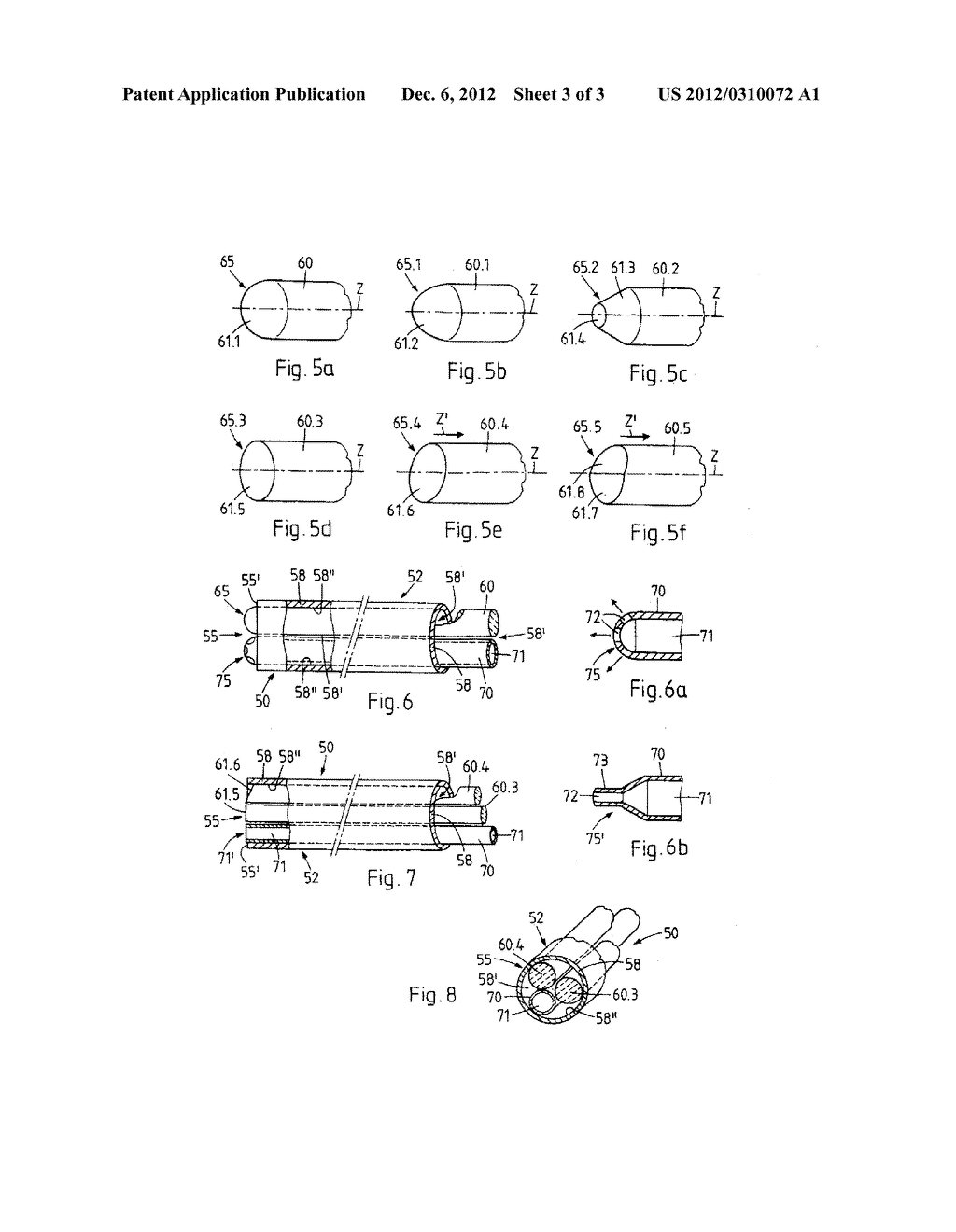 METHOD AND DEVICE FOR THE PATHOLOGY ANALYSIS OF THE SCHLEMM'S CANAL - diagram, schematic, and image 04