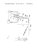 FLUID INTERCONNECTION SET WITH PARTICLE FILTER diagram and image