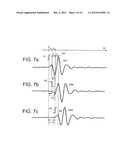 ULTRASOUND IMAGE DIAGNOSTIC APPARATUS diagram and image