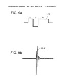 ULTRASOUND IMAGE DIAGNOSTIC APPARATUS diagram and image