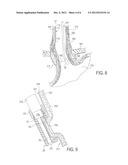 APPARATUS AND METHOD FOR TREATING TISSUE diagram and image