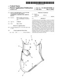 Device for providing a vacuum for vacuum wound treatment comprising a     holding or carrying device diagram and image