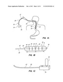 CRYOGENIC BALLOON ABLATION INSTRUMENTS AND SYSTEMS diagram and image