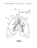 SYSTEMS, APPARATUSES, AND METHODS FOR TREATING TISSUE AND CONTROLLING     STENOSIS diagram and image