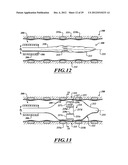 SYSTEMS, APPARATUSES, AND METHODS FOR TREATING TISSUE AND CONTROLLING     STENOSIS diagram and image