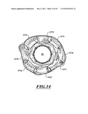 SYSTEMS, APPARATUSES, AND METHODS FOR TREATING TISSUE AND CONTROLLING     STENOSIS diagram and image