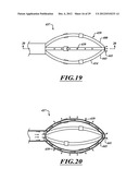 SYSTEMS, APPARATUSES, AND METHODS FOR TREATING TISSUE AND CONTROLLING     STENOSIS diagram and image