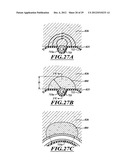 SYSTEMS, APPARATUSES, AND METHODS FOR TREATING TISSUE AND CONTROLLING     STENOSIS diagram and image