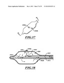 SYSTEMS, APPARATUSES, AND METHODS FOR TREATING TISSUE AND CONTROLLING     STENOSIS diagram and image