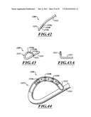 SYSTEMS, APPARATUSES, AND METHODS FOR TREATING TISSUE AND CONTROLLING     STENOSIS diagram and image