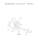 HIGH-VOLTAGE PULSE ABLATION SYSTEMS AND METHODS diagram and image