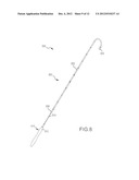 HIGH-VOLTAGE PULSE ABLATION SYSTEMS AND METHODS diagram and image