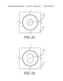 Ablation Catheters and Associated Systems and Methods diagram and image