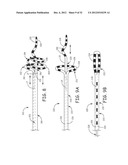 Ablation Catheters and Associated Systems and Methods diagram and image