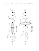 Ablation Catheters and Associated Systems and Methods diagram and image