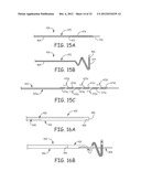 Ablation Catheters and Associated Systems and Methods diagram and image