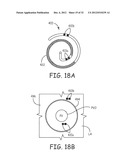 Ablation Catheters and Associated Systems and Methods diagram and image