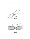 VESSEL SEALER AND DIVIDER diagram and image