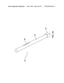 INTEGRATED SYSTEM FOR CLEANING BONE AND MILLING THE CLEANED BONE TO FORM     BONE CHIPS diagram and image