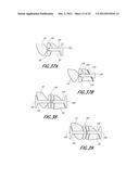 METHOD OF USING A VERTEBRAL FACET JOINT DRILL diagram and image