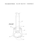 METHOD OF USING A VERTEBRAL FACET JOINT DRILL diagram and image