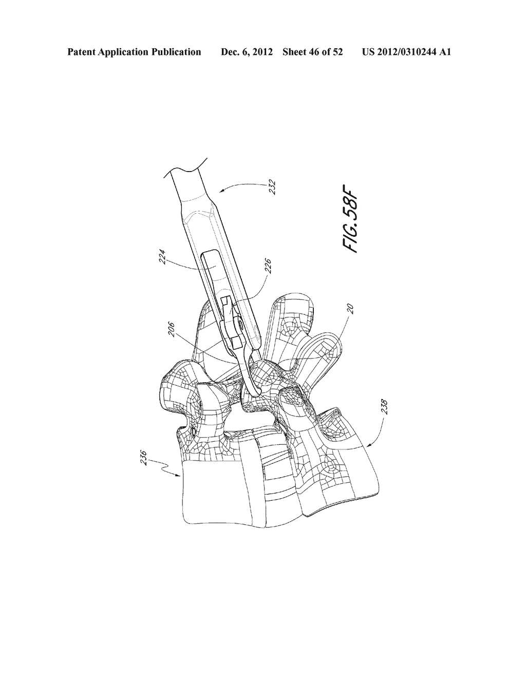METHOD OF USING A VERTEBRAL FACET JOINT DRILL - diagram, schematic, and image 47
