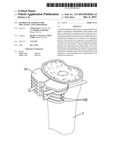 Method And Apparatus For Implanting A Knee Prosthesis diagram and image