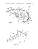 Method And Apparatus For Implanting A Knee Prosthesis diagram and image