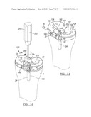 Method And Apparatus For Implanting A Knee Prosthesis diagram and image