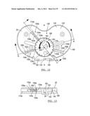 Method And Apparatus For Implanting A Knee Prosthesis diagram and image