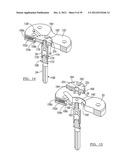 Method And Apparatus For Implanting A Knee Prosthesis diagram and image