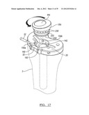 Method And Apparatus For Implanting A Knee Prosthesis diagram and image