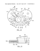 Method And Apparatus For Implanting A Knee Prosthesis diagram and image