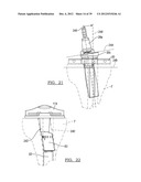 Method And Apparatus For Implanting A Knee Prosthesis diagram and image